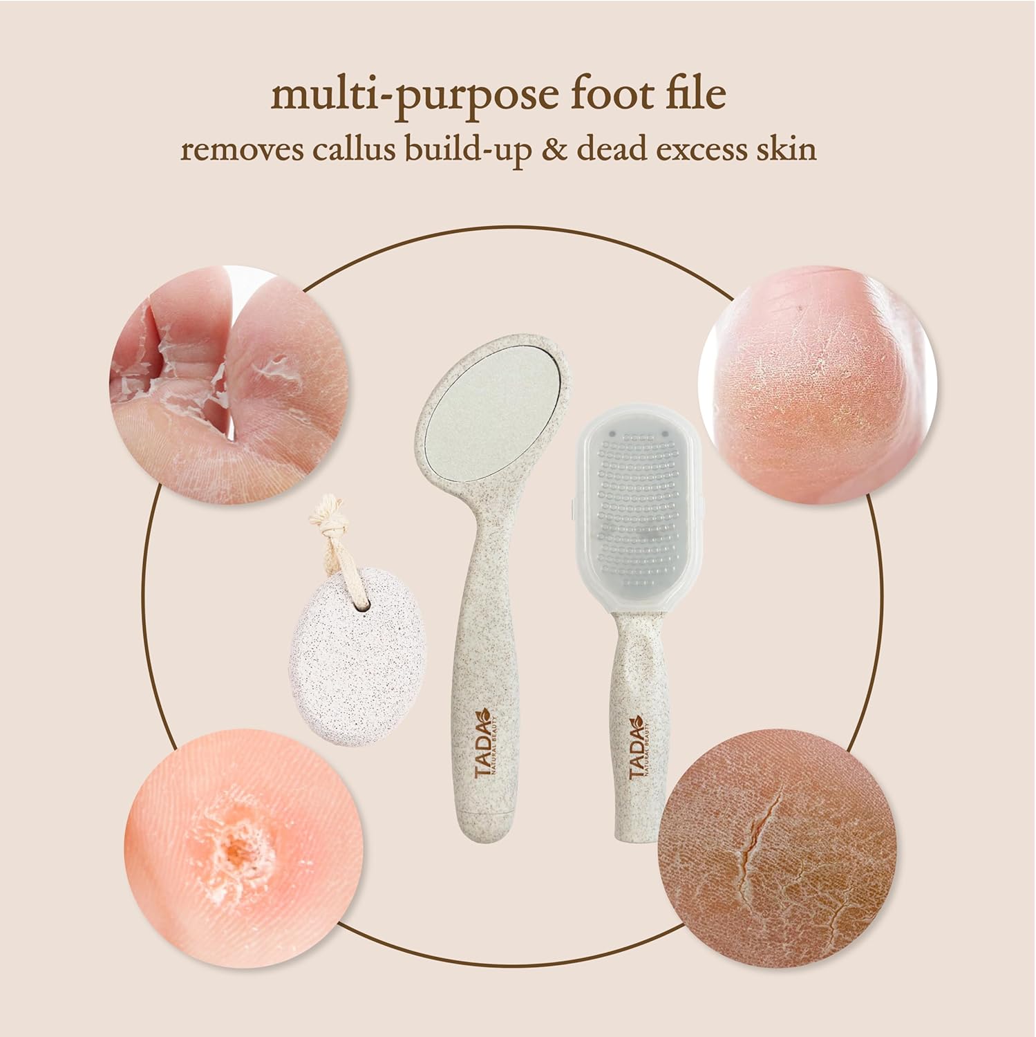 TADA Natural Beauty 3PK Foot Scrubber Set – Callus Remover Kit with Foot File, Natural Pumice Stone for Feet, Pedicure Kit for Women, at Home Foot Spa Gift Set