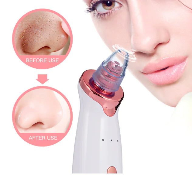 Electric Blackhead Remover Facial Cleansing Device